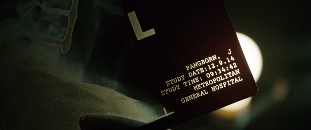 X-ray dated 12.9.14.